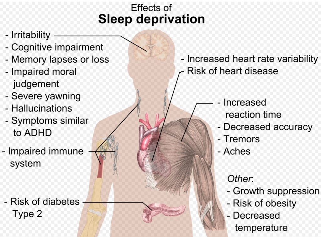 pictorial of the effect of sleep on the body